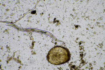 microorganisms and soil biology, with nematodes and fungi under the microscope. in a soil and...