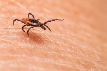 Closeup of running parasitic deer tick on textured human skin. Ixodes ricinus. Dangerous insect parasite in dynamic motion between hairs on blurry background. Carrier of encephalitis and Lyme disease.