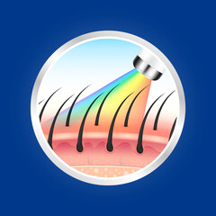 IPL light (Intense Pulsed Light) and laser hair removal unwanted out make skin smooth. Medical beauty concept. 3D Realistic vector EPS10. Silver labels are used for product label design.