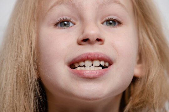 Girl shows teeth with a gap, malocclusion