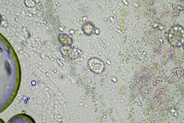 person with a virus coughing, Phlegm and mucus under the microscope