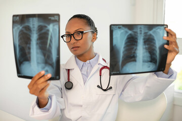 Portrait of young female doctor examining radiological images. African American general practitioner wearing glasses looking at x-ray pictures of lungs. Radiology research, pneumonia or asthma concept - obrazy, fototapety, plakaty