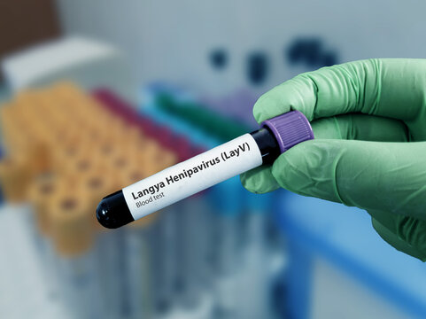 Langya Henipavirus Test