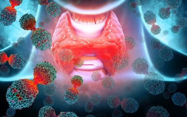 Thyroid gland cancer. Cancer cells attacking the thyroid gland. 3d illustration - obrazy, fototapety, plakaty