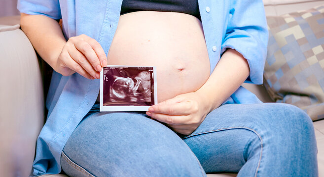 pregnant woman sitting on sofa and holding ultrasound picture of unborn baby 