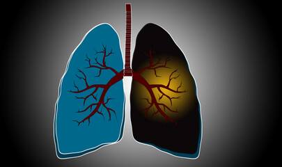 Lung health, concept. Virtual glowing lungs on black background
