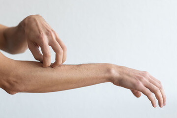 Dermatitis, eczema, allergy, psoriasis concept. man scratching itch on his arm, grey studio background. man itching rash on his elbow, copy space