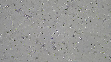 Sperm under the microscope. Looking a semen swimming. Healthy fertile man high sperm count