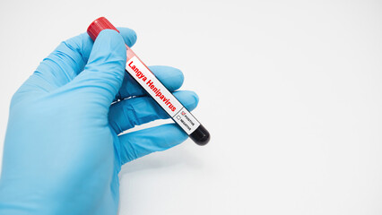 Concept detection of LayV and Langya henipavirus from blood-filled test tubes in a laboratory.