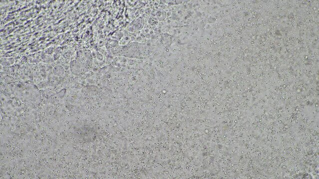 human sperm under the microscope