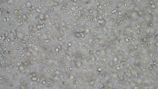 Sperm under the microscope. Looking a semen swimming. Healthy fertile man high sperm count