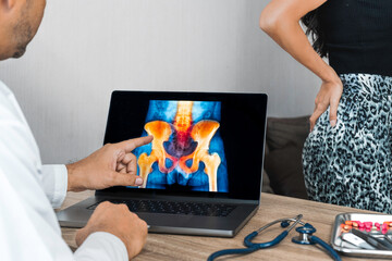 Doctor showing a x-ray of pain in the hips on a laptop. Woman patient in the background