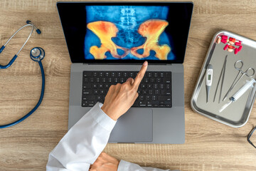 Top view of doctor showing a x-ray of pain in the hips on a laptop. 