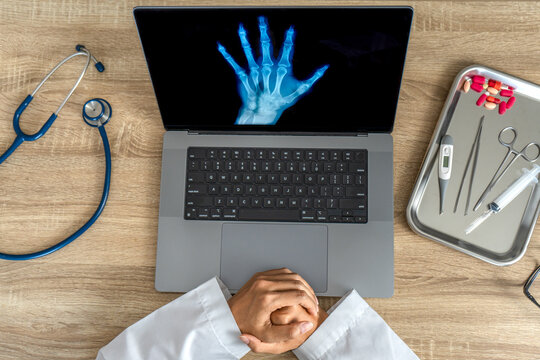 Top view of doctor looking x-ray of hand