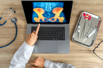 Top view of doctor showing a x-ray of pain in the hips on a laptop. 