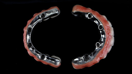 excellent composition top view of two dental prostheses made of ceramic and titanium on a black background