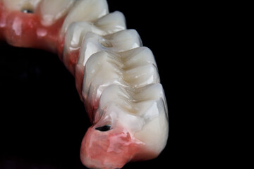 part of the prosthesis with the morphology of the relief of the teeth on a black background