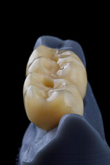 two dental crowns of chewing teeth from zircon with morphology on a model on a black background