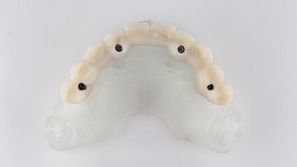 top view of model with upper jaw prosthesis on white background © Dental Pro Content