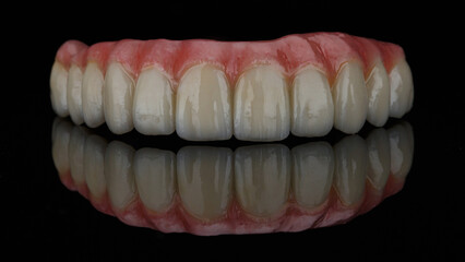 dental prosthesis of the upper jaw with natural gums on black glass with reflection © Dental Pro Content