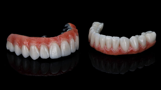 two excellent dental prostheses made of ceramics and titanium of the upper and lower jaws on a black background
