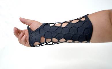 Orthopedic plastic prosthesis printed on powder 3D printer on hand isolated on white background....