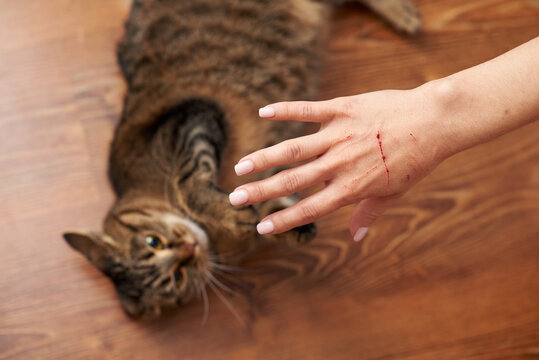 Female hand with bloody scratches from an angry cat