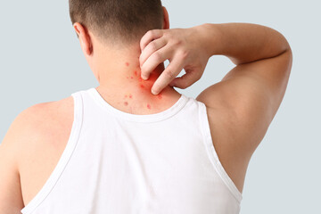 Teenager ill with monkeypox on light background