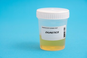 Diuretics. Diuretics toxicology screen urine tests for doping and drugs - obrazy, fototapety, plakaty