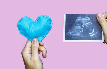 ultrasound picture and blue soft toy textile heart isolated on pink background.pregnant woman...