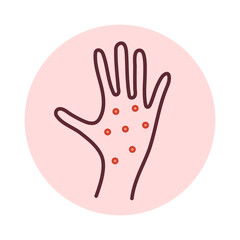 Rash on hand. Allergy, monkeypox, virus skin diseases, skin problems. Line icon..