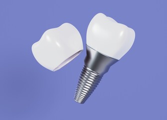 Dental implant and dental crown on an isolated blue background illustration on the theme of dentist services 3d render