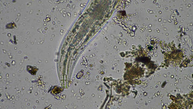 microorganisms and soil biology, with nematodes and fungi under the microscope. in a soil and compost sample