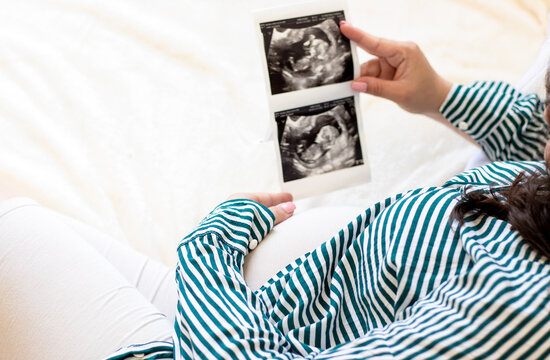 pregnant woman hold ultrasound picture scan unborn yet fetus back top view,over the shoulder.female lies in bed look analise admire baby photos or sits on knees on bed.bedroom interior.hand on belly.