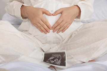 Obraz na płótnie Canvas Pregnant woman with ultrasound scan on bed, closeup