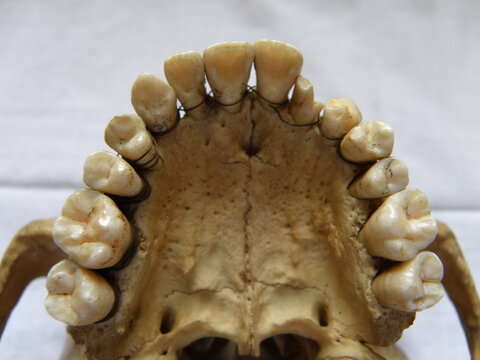 Sch&auml;del, Anatomie, anatomy, skull, bone