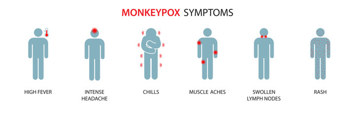 Symptoms of the monkey pox virus. Monkey pox is spreading. This causes skin infections. Infographic of symptoms of the monkey pox virus