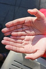 Wrinkles on the palms from soaking in water for too long