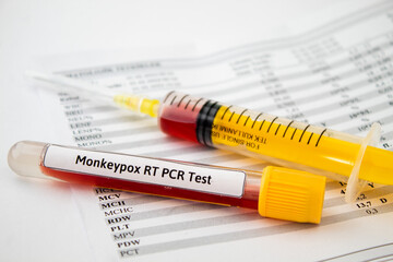 Blood tests for monkeypox virus, yellow syringe and blood test tubes on the paper of test results