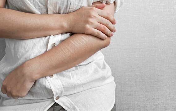 self-harm, auto-aggression and self-harm, mental health and mental illness