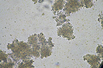 Yogurt under the microscope. Looking at lactobacillus bacteria in a healthy gut biome.