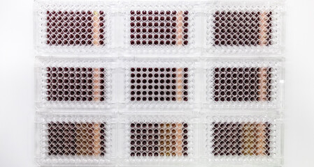 96-well plates with cancer cells cultured in vitro used in a pre-clinical drug discovery research