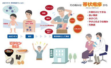 免疫機能が落ちていると発症しやすい帯状疱疹に関するイラストセット、ワクチン、ビタミンB12