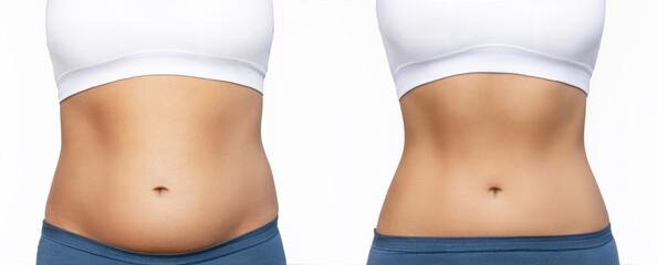 Cropped shot of a woman with excess fat and toned slim stomach with abs before and after losing...