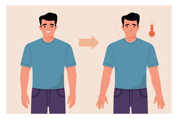 Monkeypox Virus Symptoms concept. Vector cartoon illustration of a young healthy, smiling man, and the same sad sick man with a rash on his body. Isolated on background