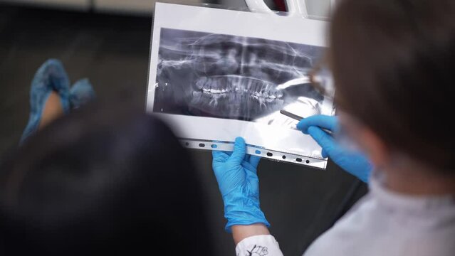 Close-up dental X-ray image in hands of dentist pointing explaining treatment to patient. Shooting over shoulder of Caucasian woman and doctor talking sitting in hospital indoors. Slow motion