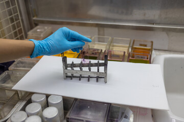 Scientists are preparing slides cytology or pathology for the pathologist to diagnose the disease in the operating room of the hospital such as dyeing, mounting