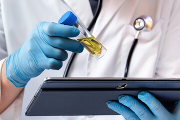 Doctor holding a tablet and analyzing the results of the urinalysis. Physician holding test tube...
