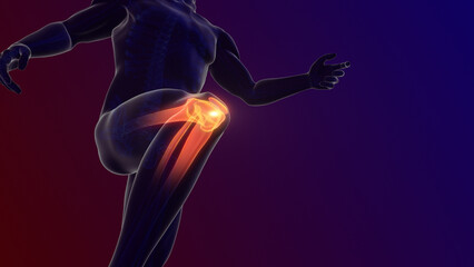 Pain in the knee joint	
 - obrazy, fototapety, plakaty