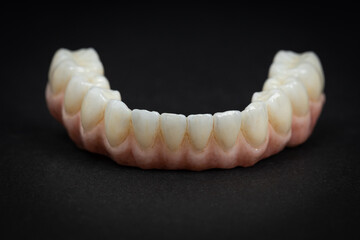 Dental health care. Close up ceramic zirconium. Dental prosthesis on zirconium oxide implants